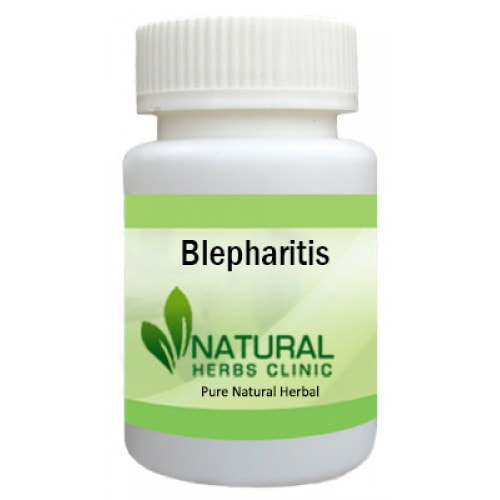 Herbal Product for Blepharitis
