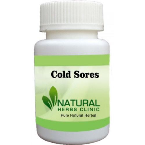 Herbal Product for Cold Sores
