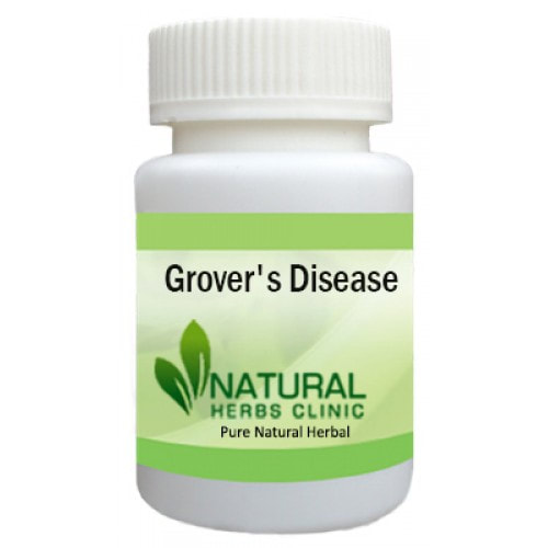 Herbal Product for Grover's Disease
