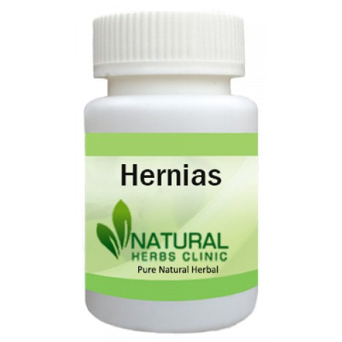 Herbal Product for Hernias
